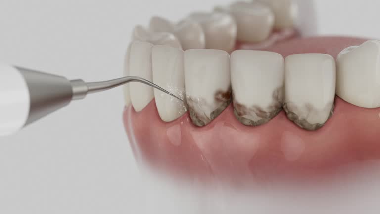 Reliable Teeth Cleaning And Checkup contractor in Tupelo, MS by Smile Center Dentistry